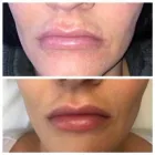 Unternehmen 4 Bild BEAUTY ART EVA WANZEK - PERMANENT MAKE-UP HAMBURG Kosmetiksalons am Hamburg HH