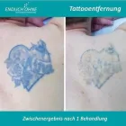 Unternehmen 18 Bild ENDLICH OHNE / FILIALE STUTTGART Schönheitskliniken am Stuttgart BW
