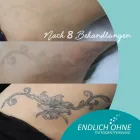 Unternehmen 6 Bild ENDLICH OHNE / FILIALE STUTTGART Schönheitskliniken am Stuttgart BW