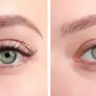 Unternehmen 25 Bild PRODERMIS KOSMETIK-PRAXIS Service & Dienstleistung am Karlsruhe BW
